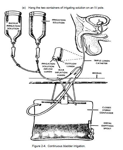 Urinalysis Gastrointestinal Urinary System Nursing Care