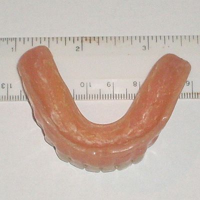 The dentures were donated by one of our wonderful volunteers.